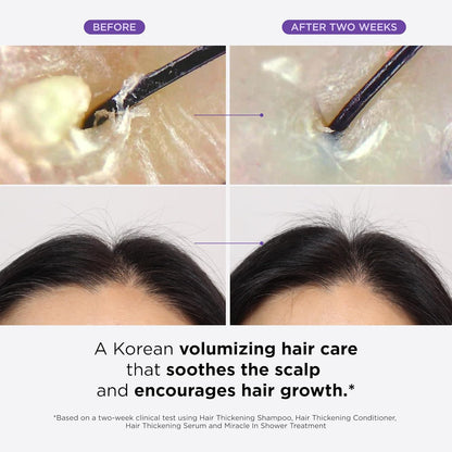 Juego de sérum, champú, acondicionador y tratamiento para el cuero cabelludo Dr. Groot Thickening para la caída del cabello